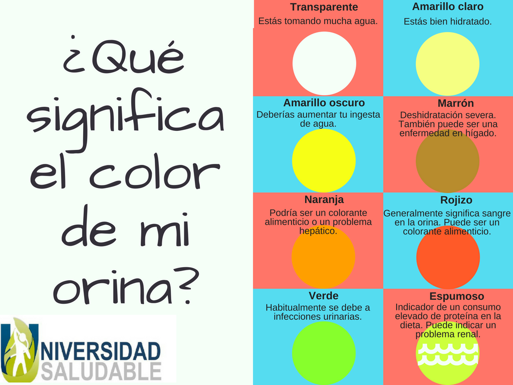 Infografía orina US