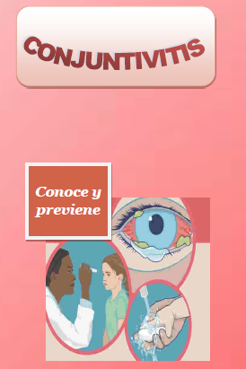 Conjuntivitis